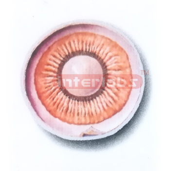 ANTERIOR PART OF THE EYEBALL (INTER-NAL ASPECT) MODEL